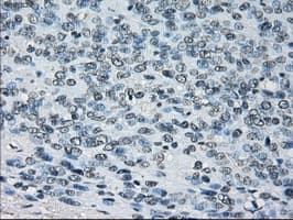 Monoclonal Mouse anti-Human PRDX4 / Peroxiredoxin 4 Antibody (clone OTI9A3, IHC, IF, WB)