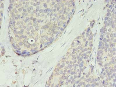 TMEM45A Antibody