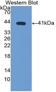 FGL1 / Hepassocin Antibody (aa23-312)