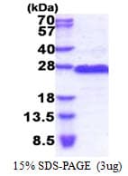 Human GAGE8 Protein (Recombinant His)