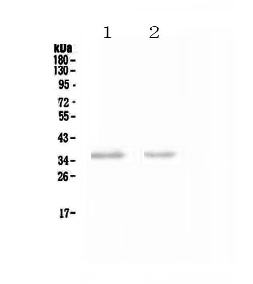 Polyclonal Rabbit anti-Human NCR1 / NKP46 Antibody (IHC, WB)