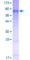 Human FAM149B1 Protein (Recombinant GST)