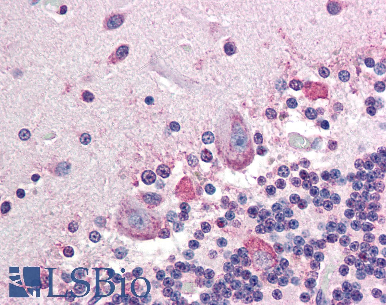 IHC-plus™ PLAP / Alkaline Phosphatase Antibody (clone H7E8)