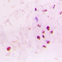RAD17 Antibody (C-Terminus)
