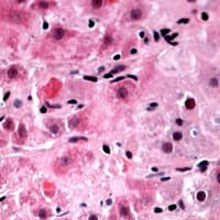Polyclonal Rabbit anti-Human TIGD3 Antibody (C-Terminus, IHC, WB)