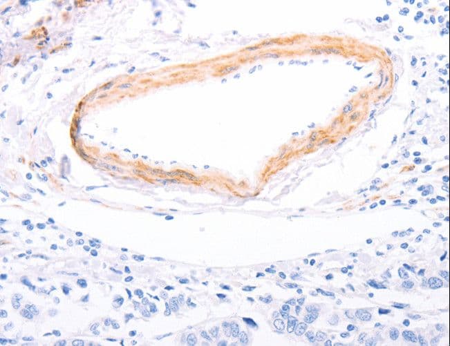 TPM1 / Tropomyosin Antibody