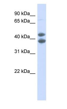 Polyclonal Rabbit anti-Human SOX4 Antibody (N-Terminus, IHC, WB)