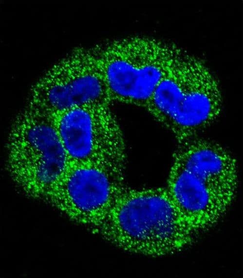 ANXA2 / Annexin A2 Antibody (aa287-313)