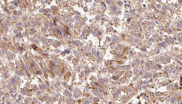 Polyclonal Rabbit anti-Human CPA6 / Carboxypeptidase A6 Antibody (IHC, WB)