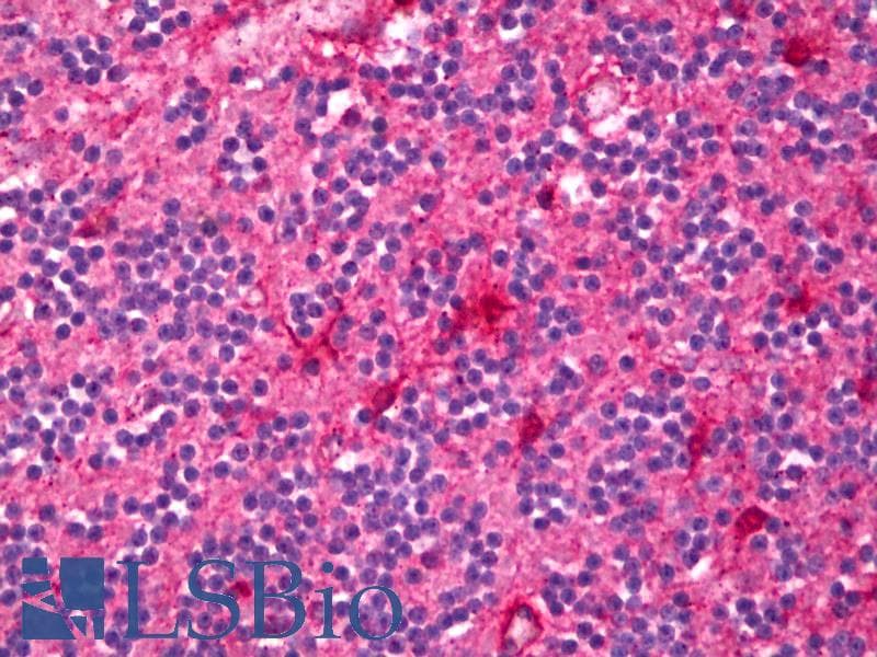 IHC-plus™ Polyclonal Rabbit anti-Rat ENPP2 / Autotaxin Antibody (IHC, WB)