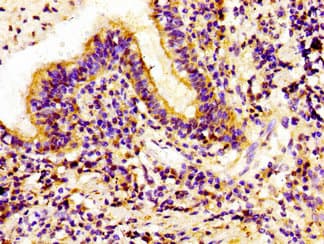 IVL / Involucrin Antibody