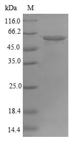 Human ATP5A1 / ATP Synthase Alpha Protein (Recombinant 6His-SUMO, N-terminus)
