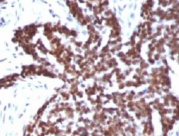 CCNB1 / Cyclin B1 Antibody (clone CCNB1/1098)