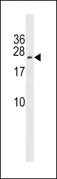 MAP3K7CL / TAK1L Antibody (aa215-241)