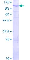 Human PAMR1 Protein (Recombinant GST)