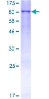 Human MMP19 Protein (Recombinant GST)
