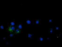 GPR49 / LGR5 Antibody (aa250-550, clone OTI1C8)