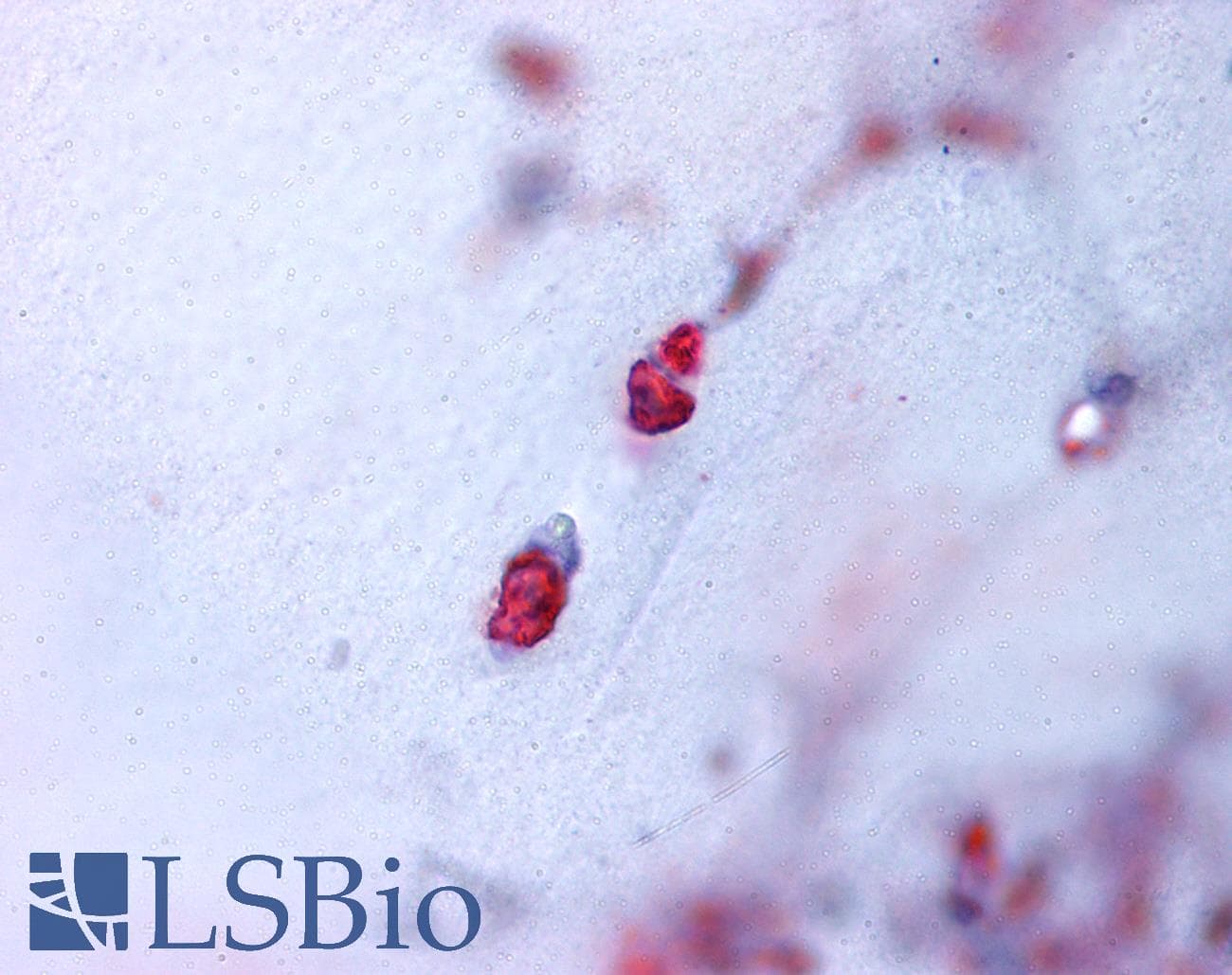 IHC-plus™ ACAN / Aggrecan Antibody (N-Terminus)