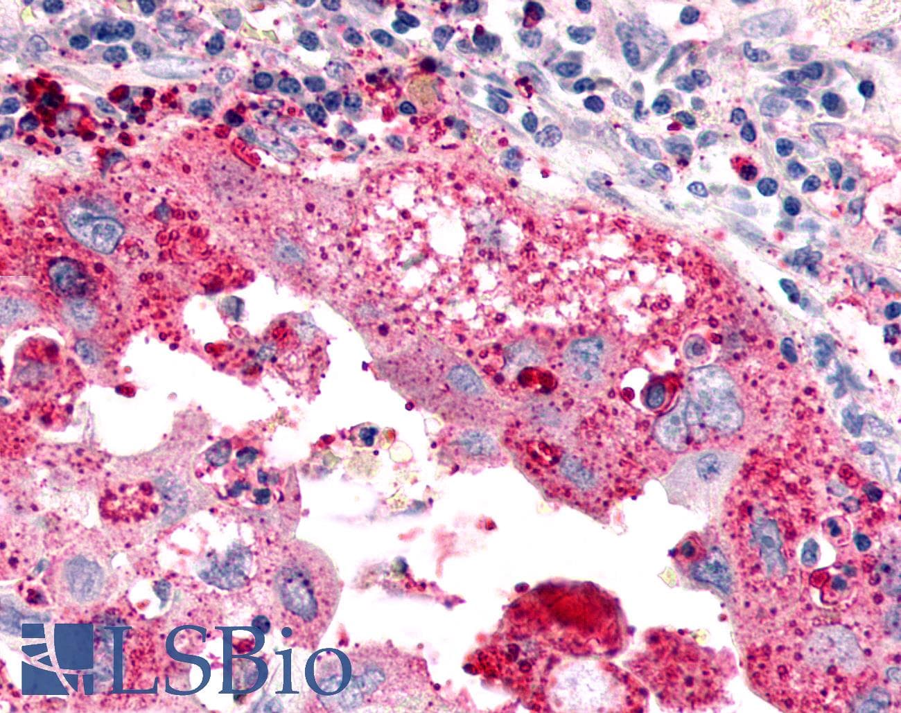 PathPlus™ Polyclonal Rabbit anti-Human ADGRL4 / ELTD1 Antibody (C-Terminus, IHC)