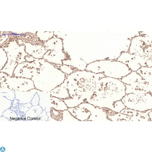 PPARD / PPAR Delta Antibody