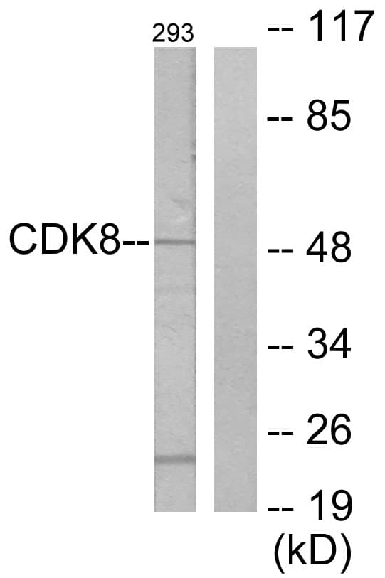 CDK8 Antibody (aa1-50)