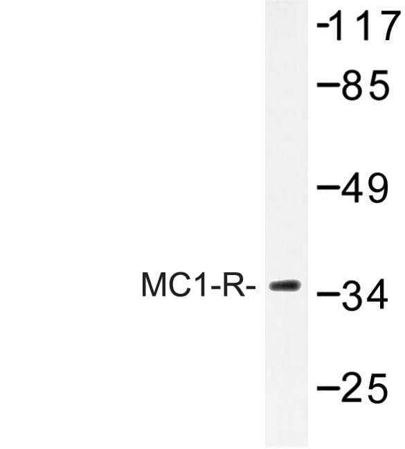 MC1R Antibody (Val312)