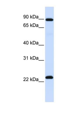 RGS19 Antibody (N-Terminus)