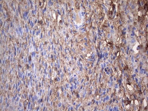 CRP / C-Reactive Protein Antibody (clone OTI7C3)