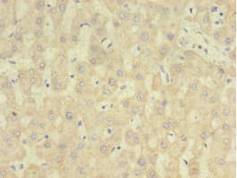 Polyclonal Rabbit anti-Human RARRES2 / Chemerin Antibody (aa21-157, IHC)