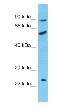 RHCE / RH Antibody (aa183-232)