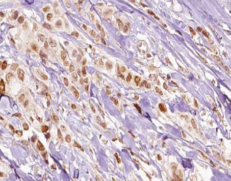 FLI1 Antibody