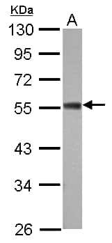 Polyclonal Rabbit anti-Human ZC3H10 Antibody (WB)