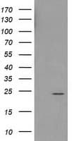 HDHD1 Antibody (clone OTI3E5)