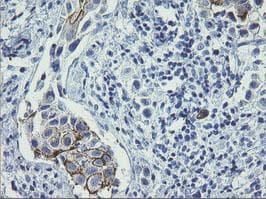Monoclonal Mouse anti-Human ERBB2 / HER2 Antibody (clone OTI7C2, Carrier-free, aa676-1255, IHC, WB)