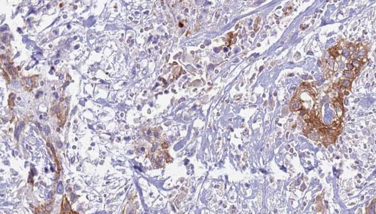 IL6ST / CD130 / gp130 Antibody