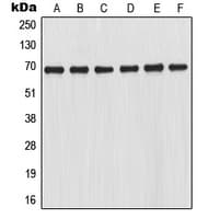 Polyclonal Rabbit anti-Human NFE2L2 / NRF2 Antibody (C-Terminus, IHC, IF, WB)