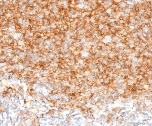 Monoclonal Mouse anti-Human CD40 Antibody (clone CDLA40-1, IHC)