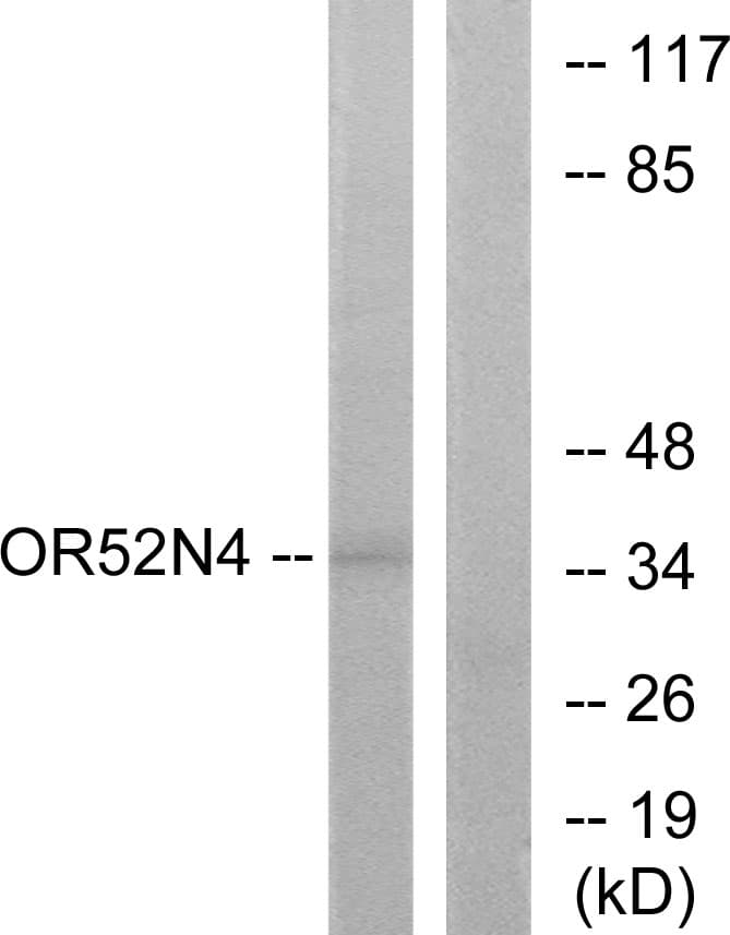 Polyclonal Rabbit anti-Human OR52N4 Antibody (aa272-321, WB)