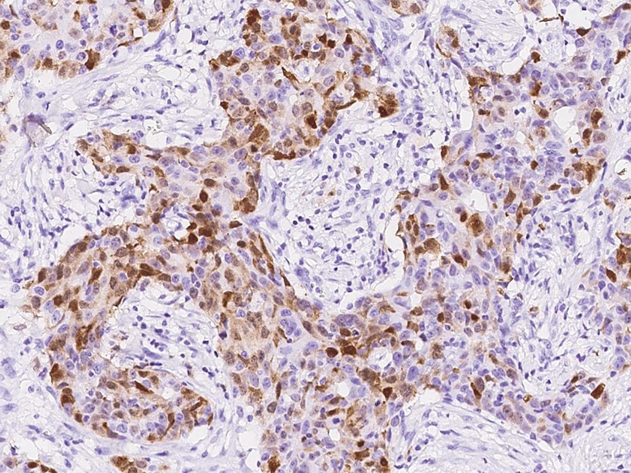 S100A8 / MRP8 Antibody (clone 216, Preservative Free)
