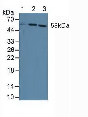 DKC1 / Dyskerin Antibody (aa298-465)
