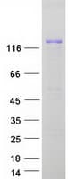 Human ERCC6 / CSB Protein (Recombinant Myc-DDK (Flag))