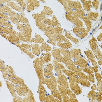 Polyclonal Rabbit anti-Human SYK Antibody (IHC, WB)