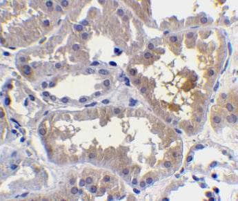 Polyclonal Rabbit anti-Human CRADD / RAIDD Antibody (aa181-199, IHC, WB)