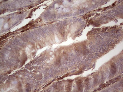 RSPO3 Antibody (aa22-272, clone OTI3A9)