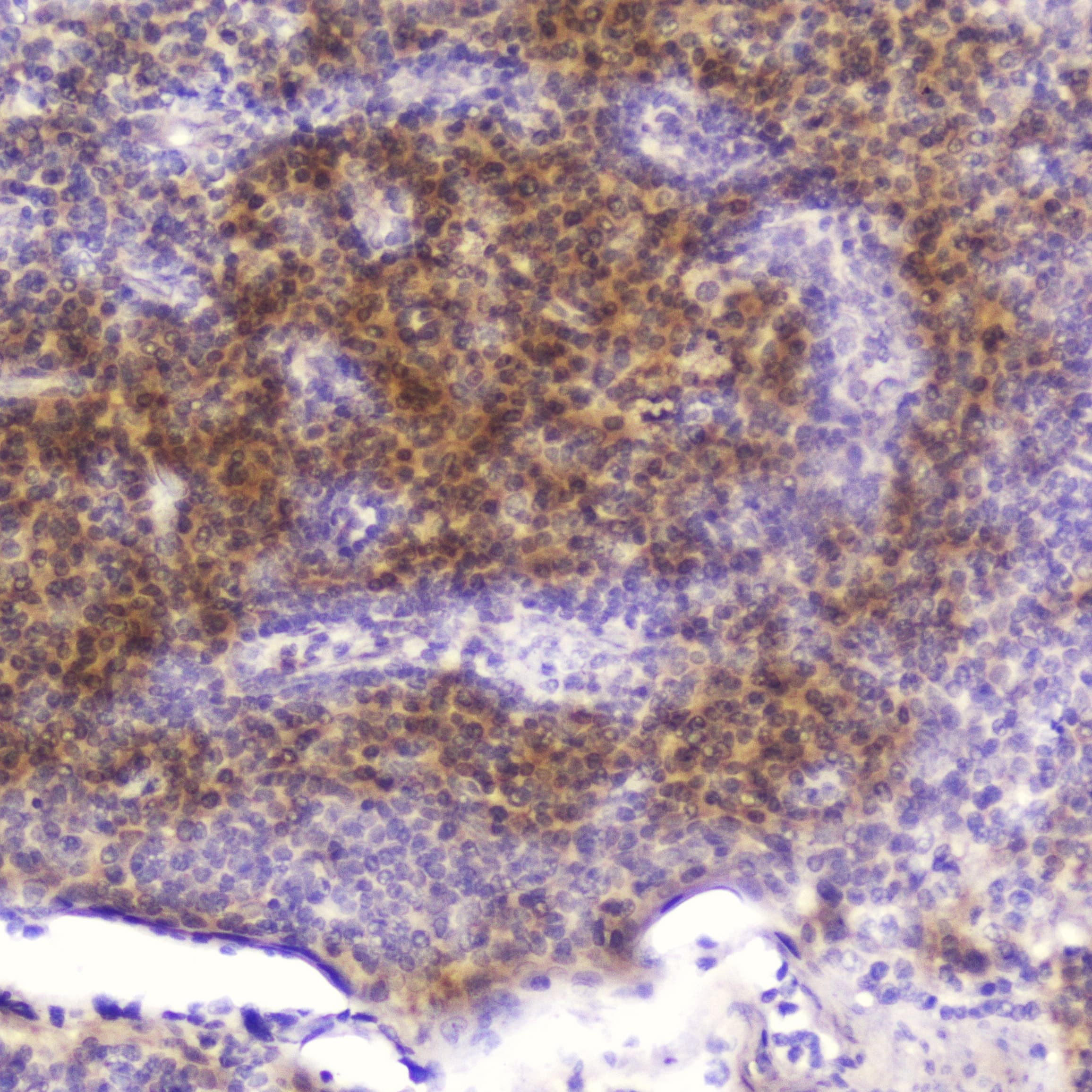FABP3 / H-FABP Antibody