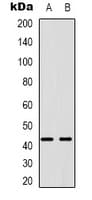 Polyclonal Rabbit anti-Human PABPC5 Antibody (Internal, IHC, WB)