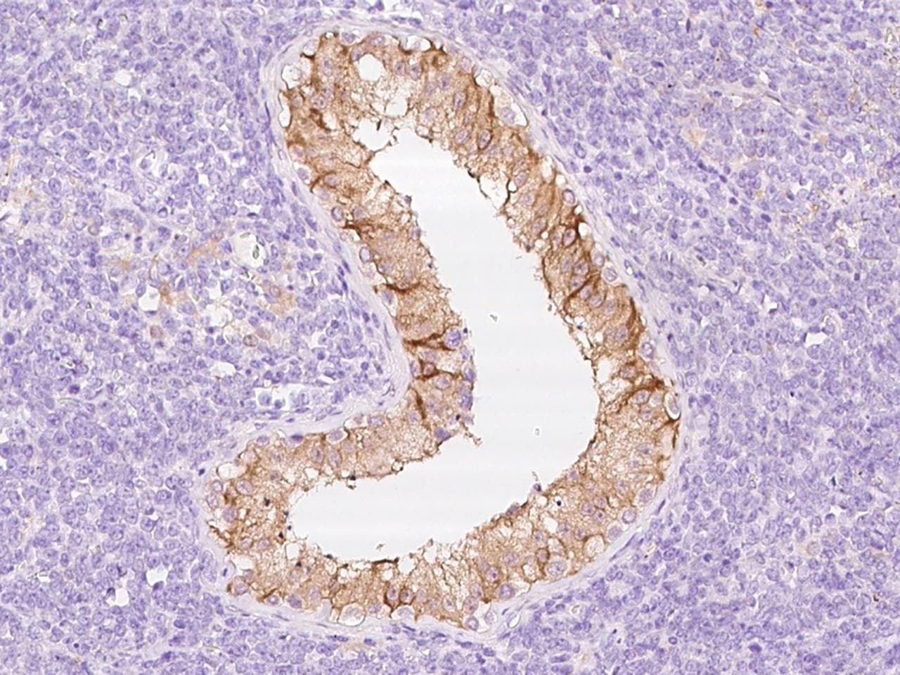 AMH / Anti-Mullerian Hormone Antibody (aa25-560, Preservative Free)