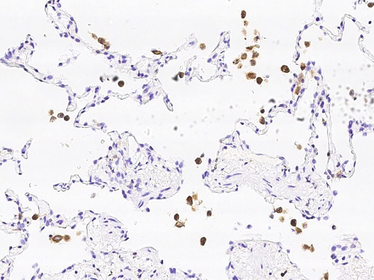 Polyclonal Rabbit anti-Human DAP12 Antibody (IHC)