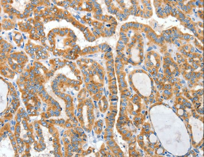 CKAP4 Antibody
