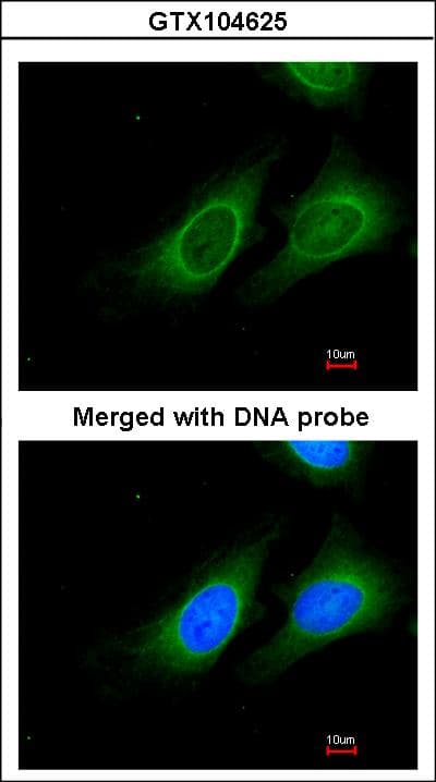 IHC-plus™ Polyclonal Rabbit anti-Human 15-PGDH / HPGD Antibody (aa205-266, IHC, WB)